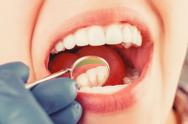 Amalgam Removal (The Huggins Protocol)