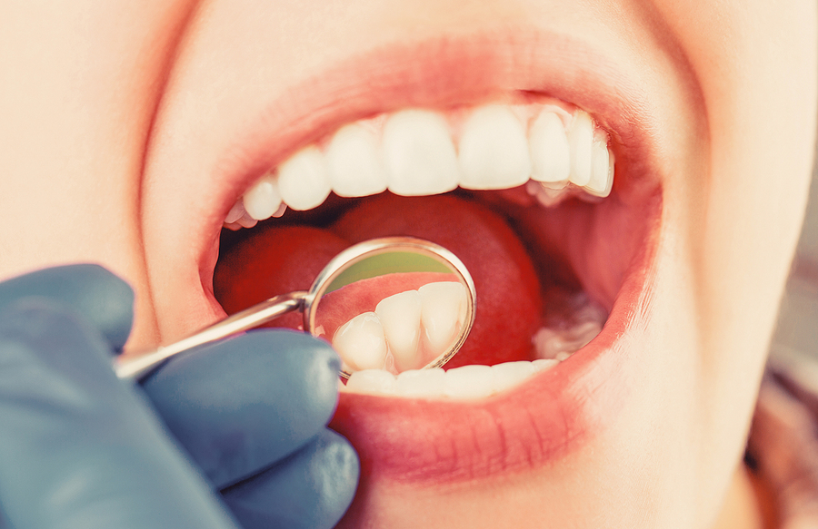 Amalgam Removal (The Huggins Protocol) Amalgam Removal (The Huggins Protocol)